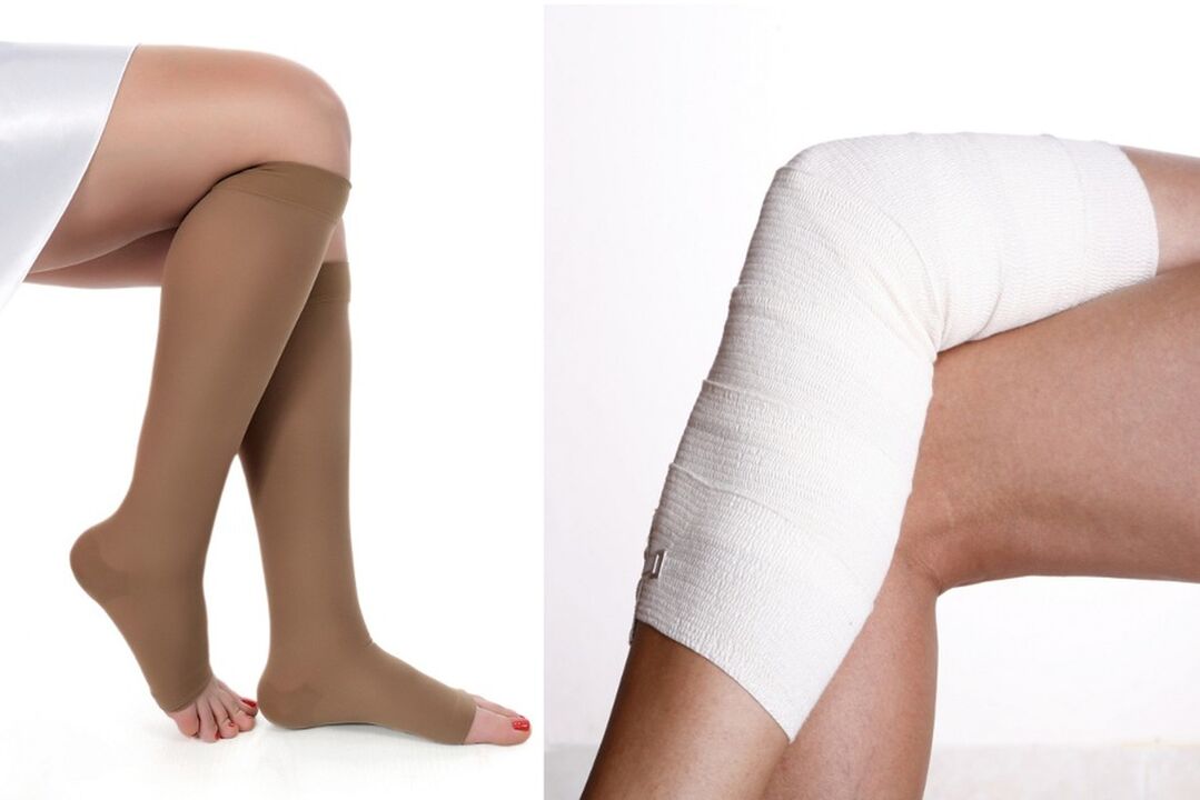 How to treat the varicose veins
