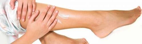 Application of medicinal cream on legs with enlarged veins