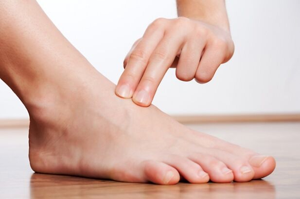 Legs without varicose veins after laser treatment