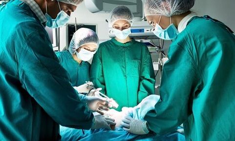 surgery for varicose veins in the legs