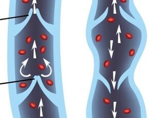 operation of the valve apparatus of the veins of the lower extremities